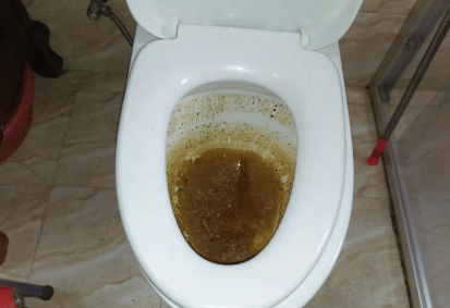 管道疏通器